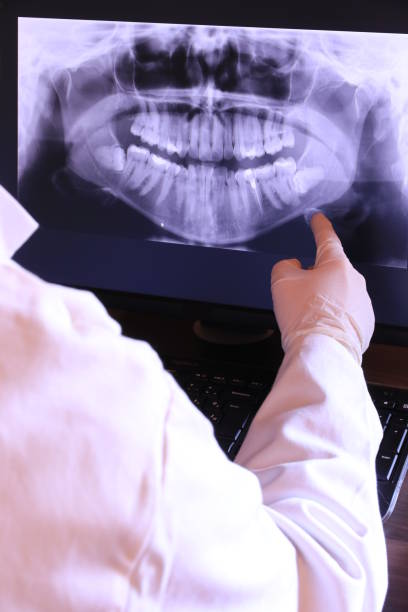 Best Broken or Chipped Tooth Repair in Vonore, TN